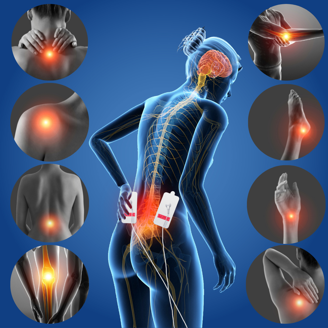 How TENS can manage your pain, drug-free.